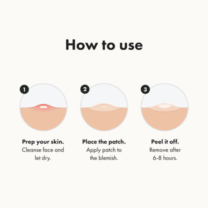 Hero Cosmetics Mighty Patch Original – Hydrocolloid Acne Pimple Patches for Whiteheads, Overnight Spot Stickers (36 Count)